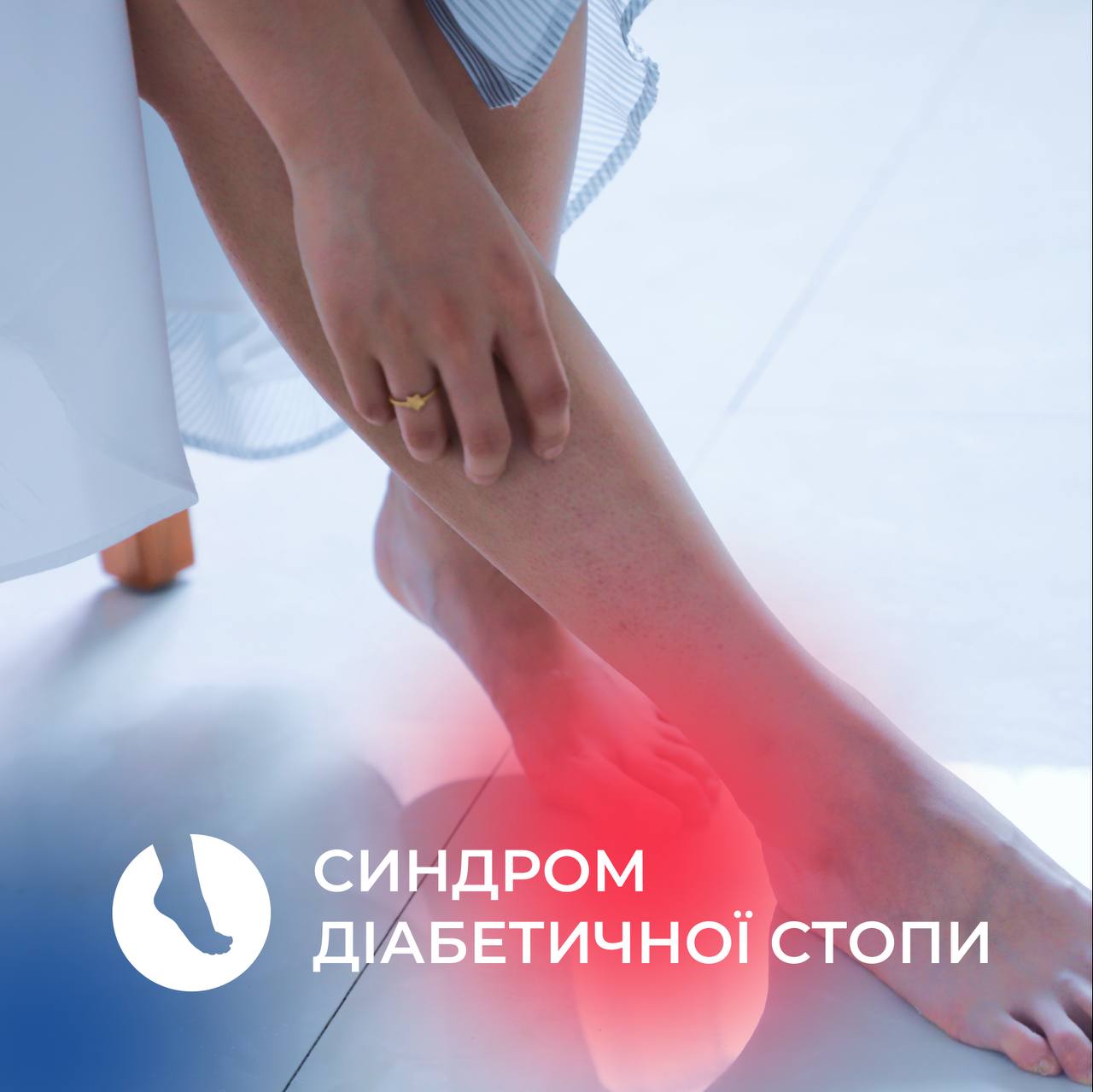 Синдром діабетичної стопи - найбільш часте ускладнення цукрового ...